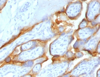 Recombinant HCG-beta Antibody / Rabbit Monoclonal
