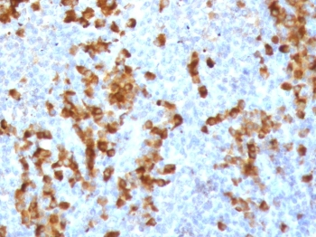Recombinant Kappa Light Chain Antibody / Rabbit Monoclonal