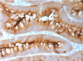 Recombinant CEA Antibody / CEACAM5