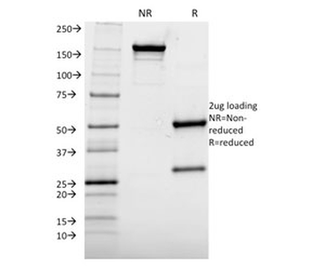 Albumin Antibody / Serum Albumin