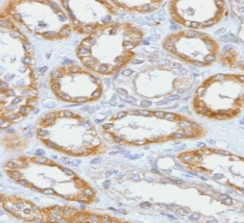Recombinant CD61 Antibody / Integrin beta 3 / ITGB3