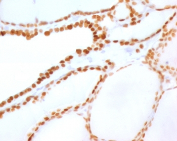 Recombinant NKX2.1 Antibody / TTF-1 Rabbit Monoclonal