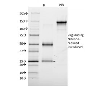 Annexin A1 Antibody