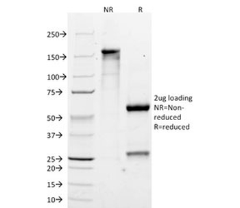 CYP2E1 Antibody / Cytochrome P450