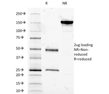 CD14 Antibody