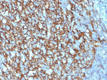 CD21 Antibody