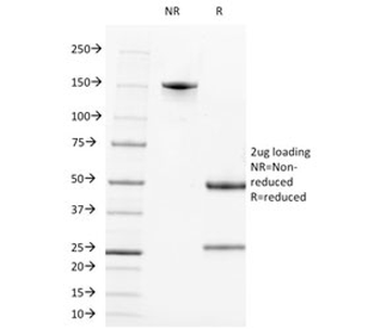 CD21 Antibody