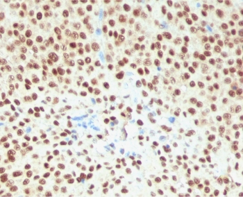 Recombinant SOX10 Antibody