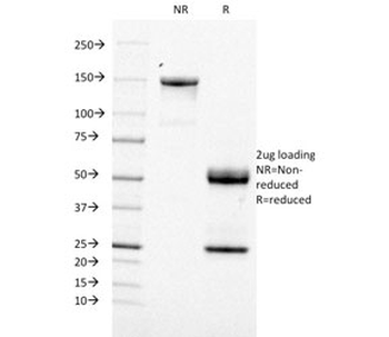 CD21 Antibody