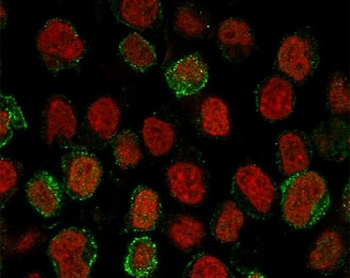 CD22 Antibody
