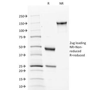 Calnexin Antibody