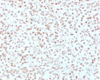AKT1 Antibody