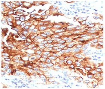 MSLN Antibody / Mesothelin
