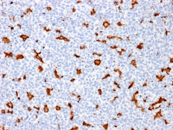 IBA1 Antibody / AIF-1