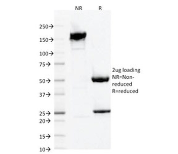 IBA1 Antibody / AIF-1