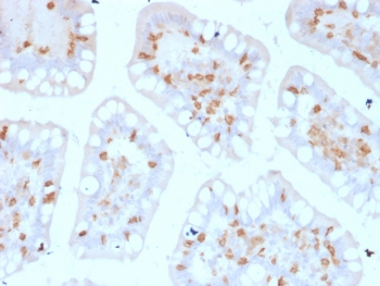 Integrin alpha E Antibody / CD103