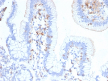 Integrin alpha E Antibody / CD103