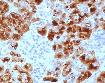 GP2 Antibody / Glycoprotein 2 / ZAP75