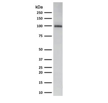 GP2 Antibody / Glycoprotein 2 / ZAP75