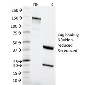 MSH6 Antibody