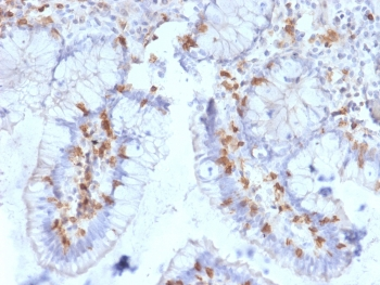 Integrin alpha E Antibody / CD103