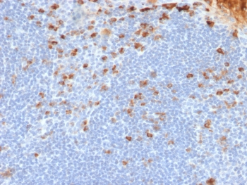 Recombinant Kappa Light Chain Antibody