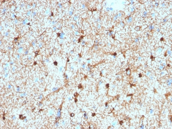 GFAP Antibody / Glial Fibrillary Acidic Protein