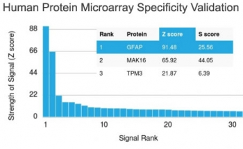 GFAP Antibody / Glial Fibrillary Acidic Protein