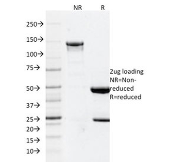 GFAP Antibody / Glial Fibrillary Acidic Protein