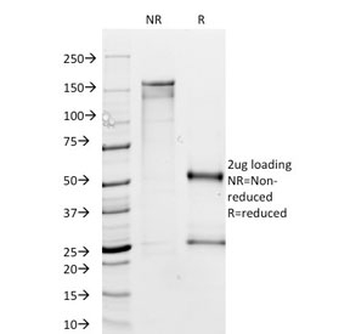 MTAP Antibody