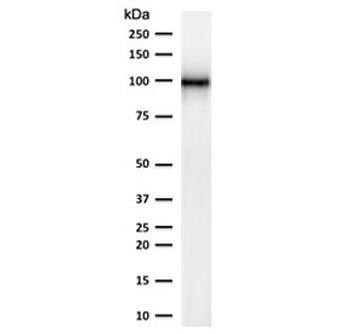 CD10 Antibody / Neprilysin