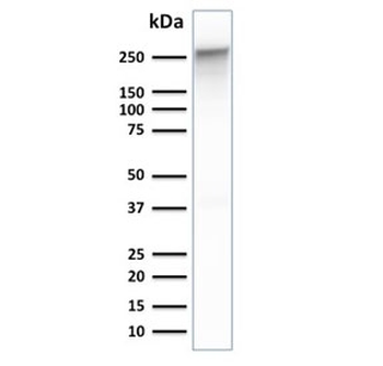Spectrin beta III Antibody / SPTBN2