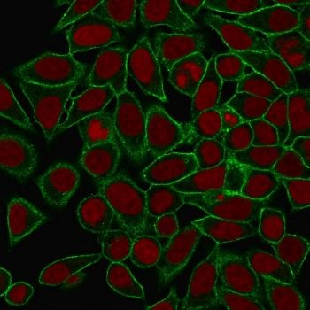 Spectrin beta III Antibody / SPTBN2