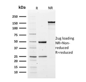 SPTA1 Antibody / Spectrin alpha 1