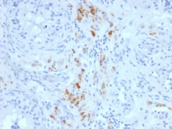 StAR Antibody / Steroidogenic acute regulatory protein
