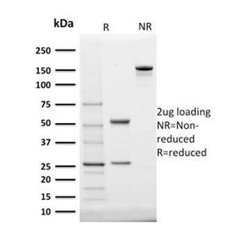 StAR Antibody / Steroidogenic acute regulatory protein
