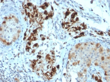 StAR Antibody / Steroidogenic acute regulatory protein