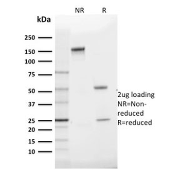 GLUT1 Antibody / SLC2A1