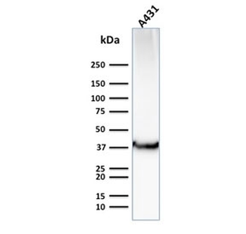 GLUT1 Antibody / SLC2A1