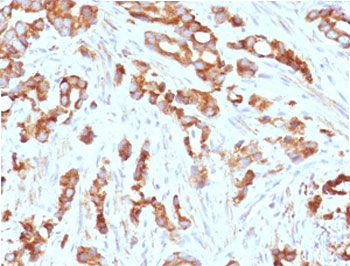 AURKB Antibody / Aurora B