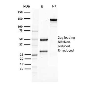 PMEL17 / Melanoma gp100 Antibody