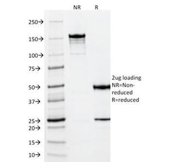 Vimentin Antibody