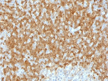 TCL1 Antibody