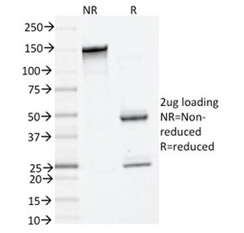 TPSAB1 Antibody / Mast Cell Tryptase