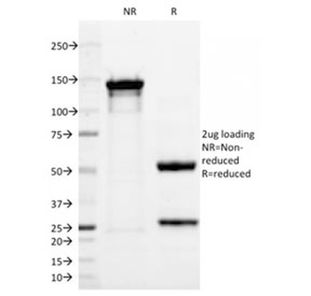 p63 Antibody / Tumor protein 63
