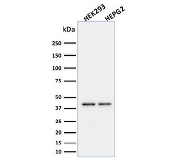 PD-L1 Antibody / B7-H1 / CD274