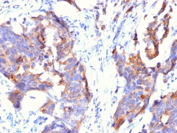 MUC1 Antibody / Mouse Monoclonal