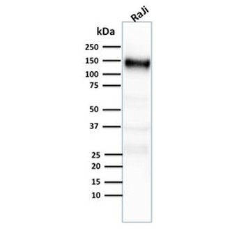 CD21 Antibody
