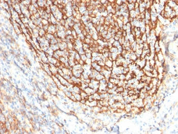 CD21 Antibody