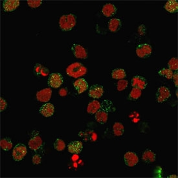 CD21 Antibody
